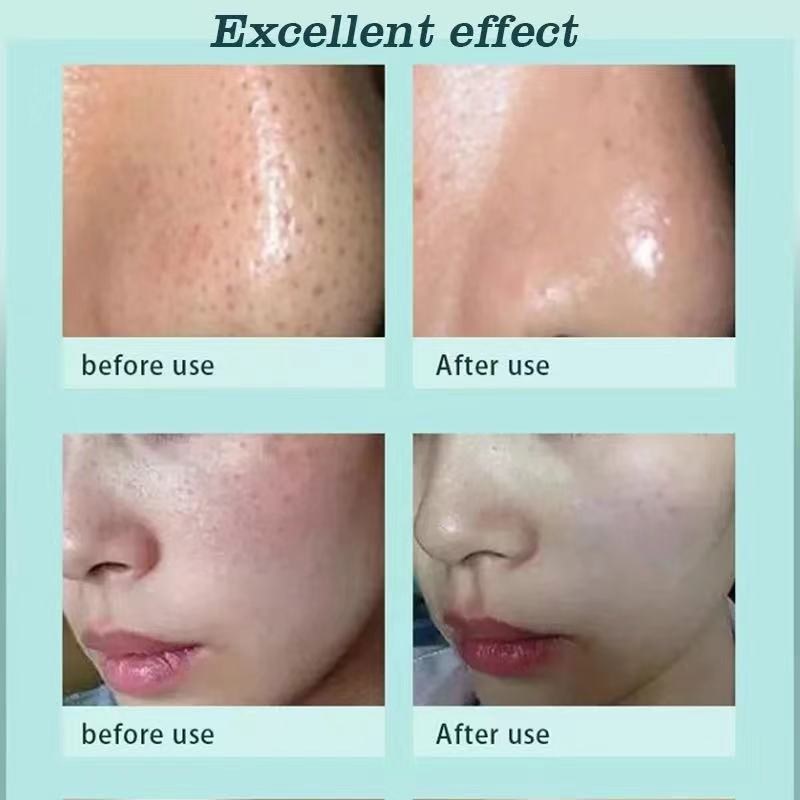8 in 1 Ultrasonic Dermabrasion Hydra Beauty Machine Water Oxygen Plasma Device Skin Cleaning For Beauty Salon SPA