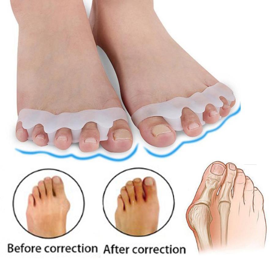 Hallux Valgus Braces Toe Separator Overlapping Toes Rehabilitation Treatment Foot Bone Ortic Device Feet Care Silicone Gel Buni6014639
Hallux Valgus Braces Toe Separator Overlapping Toes Rehabilitation Treatment Foot Bone Ortic Device Feet Care Silicone Gel Buni6014639