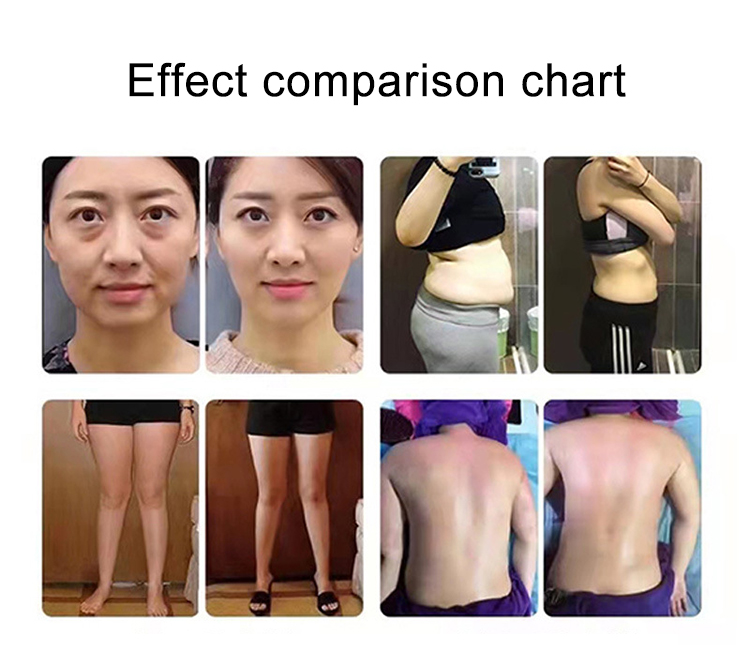 3 in 1 Indiba Newest Tech 448K Ret Cet Slimming Machine RF Therapy Physiotherapy Relief Pain Massager SPA Tecar