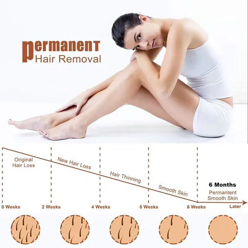 High Power Household Freeze Cooling 808Nm Diode Laser Permanent Hair Removal For Ladies IP