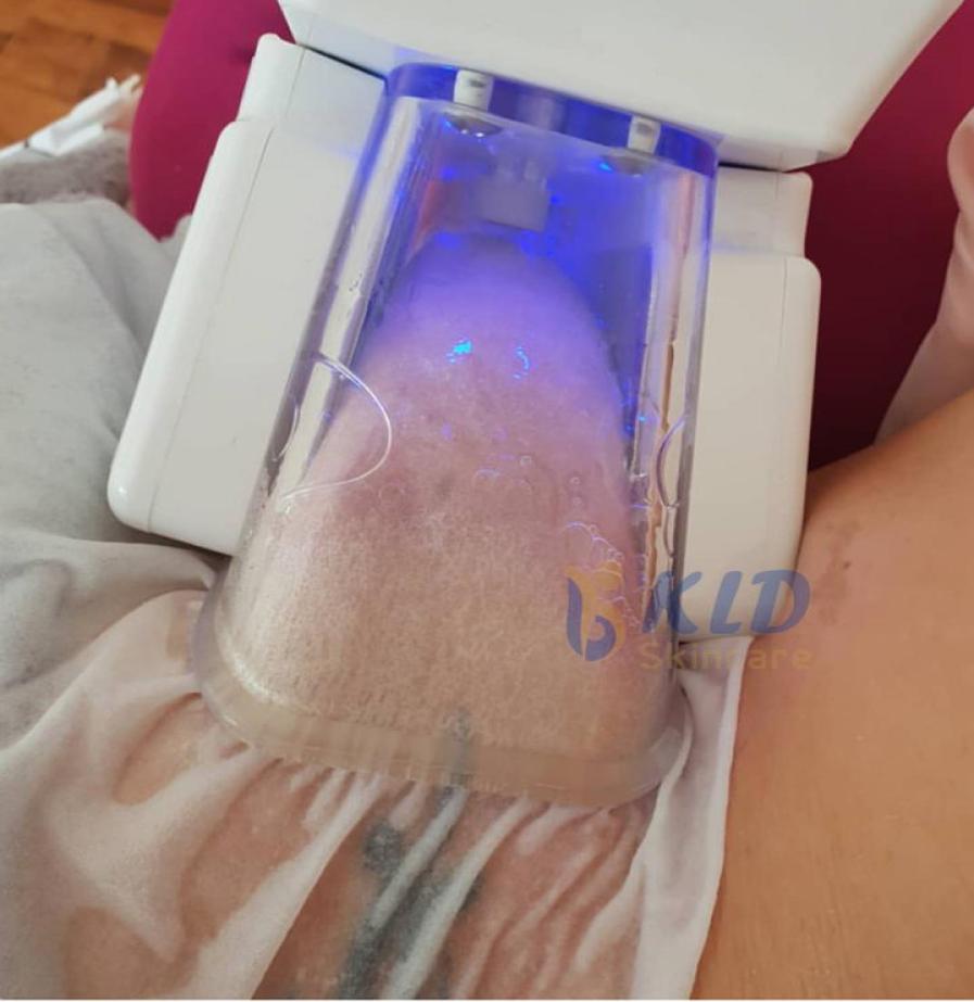 High quality Cryotherapy Slimming Fats ze Physiotherapy handles for cryolipolysis fat machine use8135474
High quality Cryotherapy Slimming Fats ze Physiotherapy handles for cryolipolysis fat machine use8135474