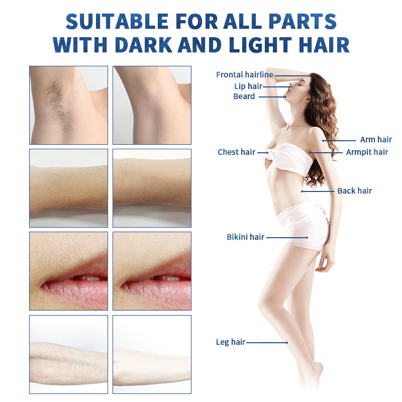 Painless Laser Fast Facial and Body Hair Remover Arm Leg Back 808 diode laser Hair Removal Device home and salon use