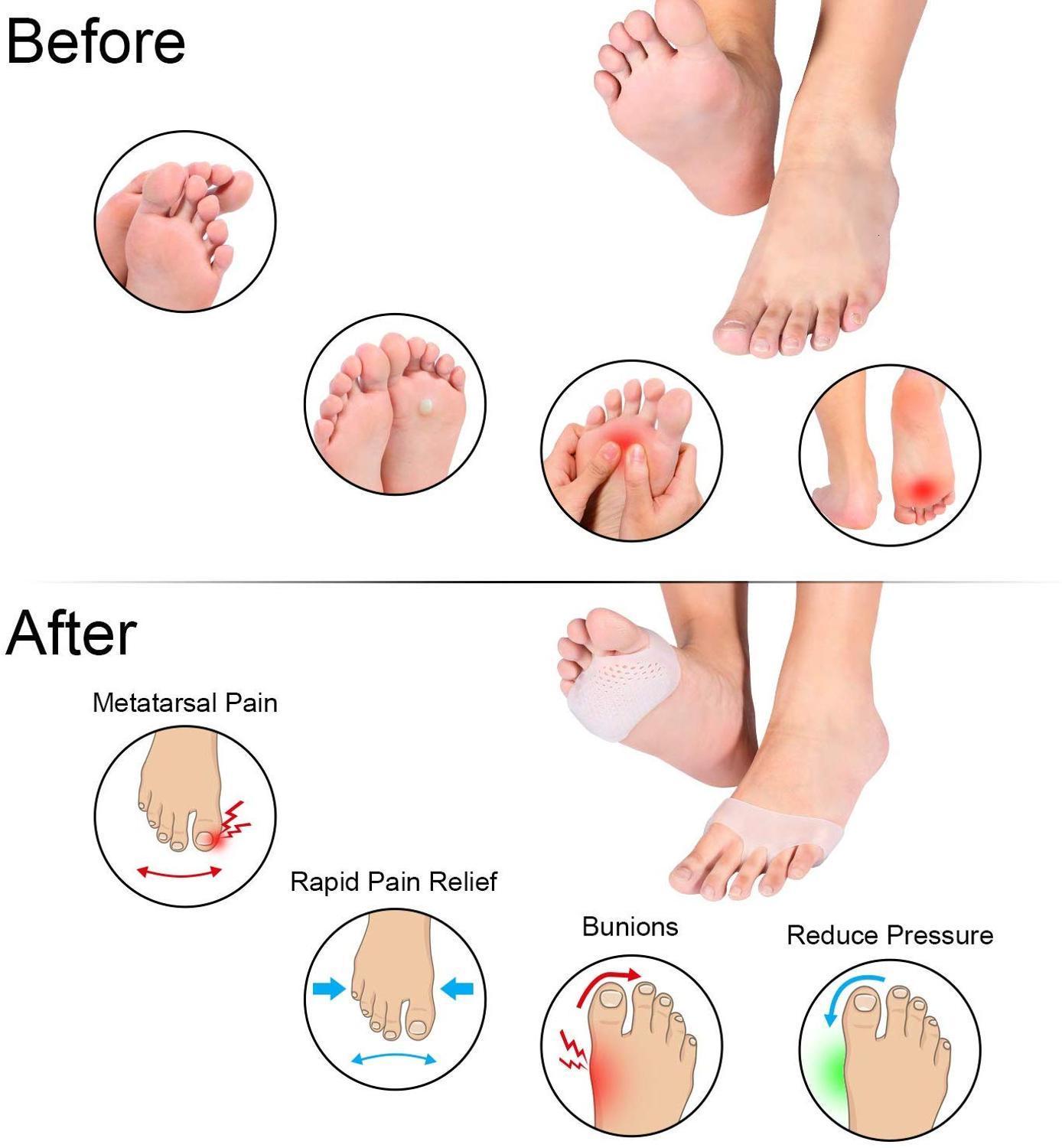 Shoe Parts Accessories Foot Rasps 10 Pairs Metatarsal Pads Ball of Foot Cushions Foot Pain Relief Pads for Women Foot Pain Forefoot Pad Gel Cushion Re