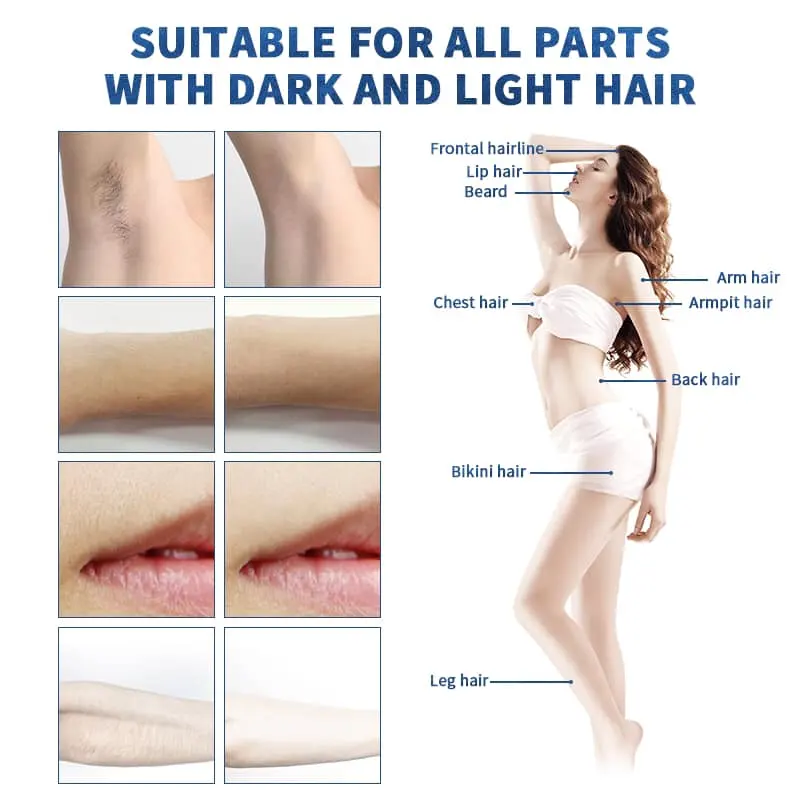 Factory Price Permanent Hair Removal Skin Rejuvenation Diode Laser 755 808 1064nm Diode Laser Machine For Safety Epilation