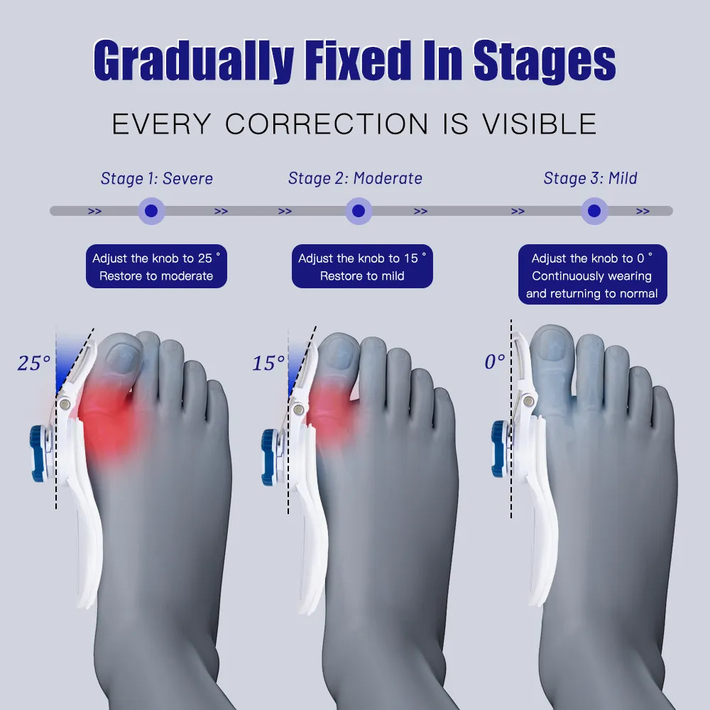 Foot Care Orthopedic Bunion Corrector Device Foot Relief Hallux Valgus Toe Correction Pedicure Feet Bone Thumb Adjuster Foot Massager 231006