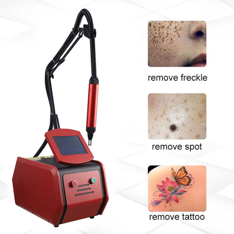 Q Switched Nd Yag Pico Laser Carbon Peel Tattoo Removal Skin Care Acne Treatment Spot Pigment Freckle Remover