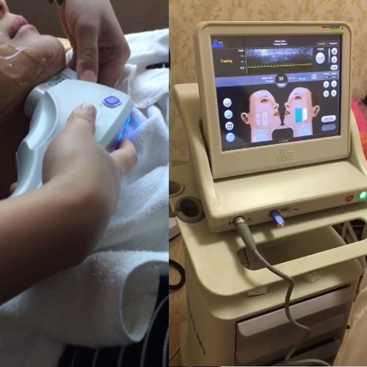 Non-Invasive 12 Lines Hifu Machine Face Body 4d Hifu Anti wrinkle 5d Hifu Body Portable Mini Smas Lift Hifu Face Machine
