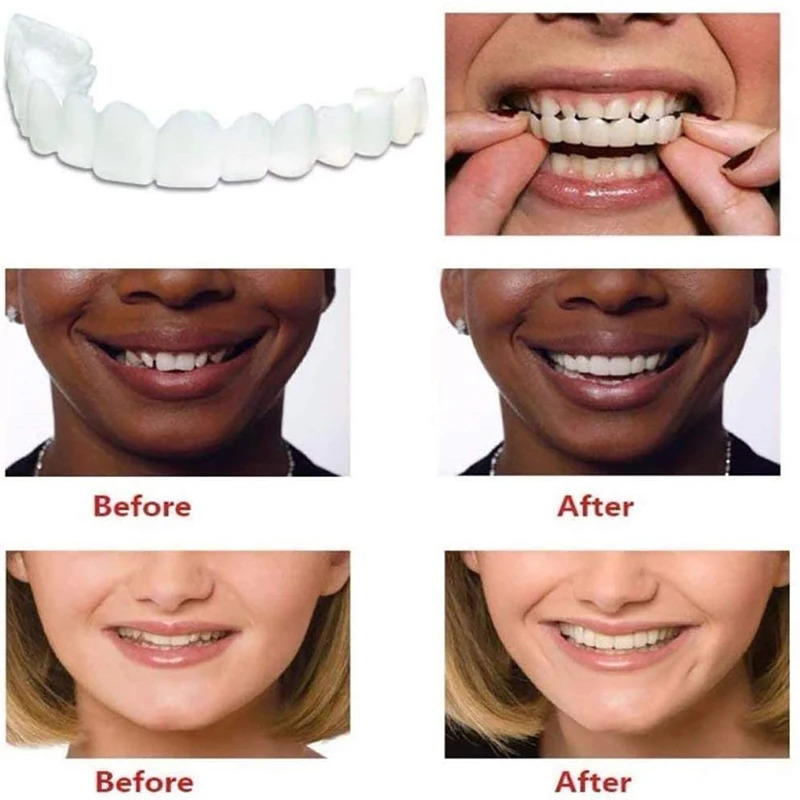 Other Oral Hygiene False Dental Braces Tooth Cover Simulation Chewing Braces Dental Beauty Correction Shaping Universal Dental Defect Repair Braces 23