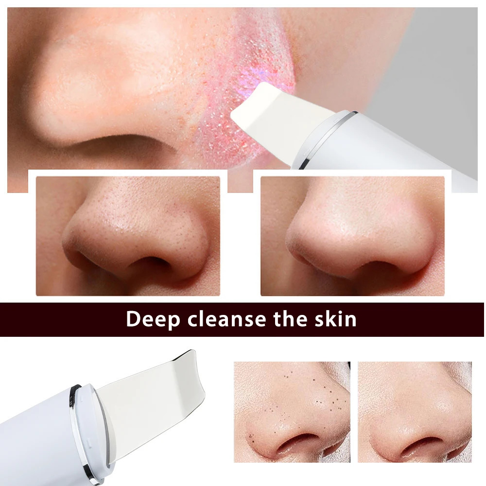 Face Care Devices Ultrasonic Skin Scrubber Blackhead Remover Cleanser 4 Modes Peeling Shovel Face Lifting Tool EMS Spatula Deep Cleansing 231012