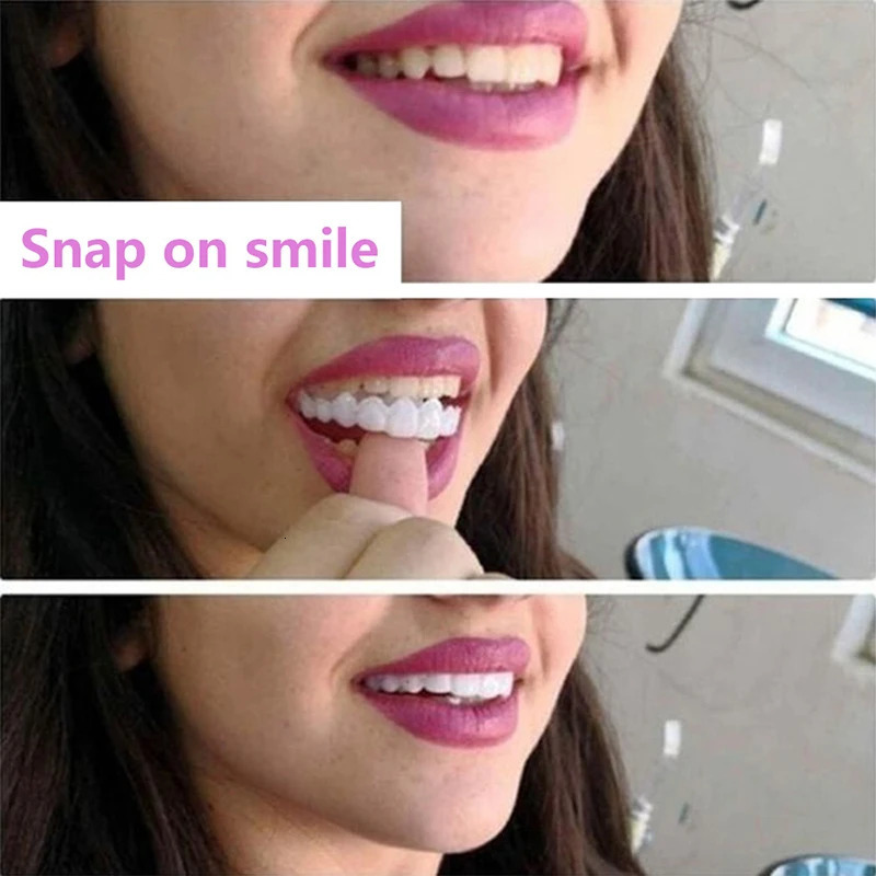 Other Oral Hygiene False Dental Braces Tooth Cover Simulation Chewing Braces Dental Beauty Correction Shaping Universal Dental Defect Repair Braces 23