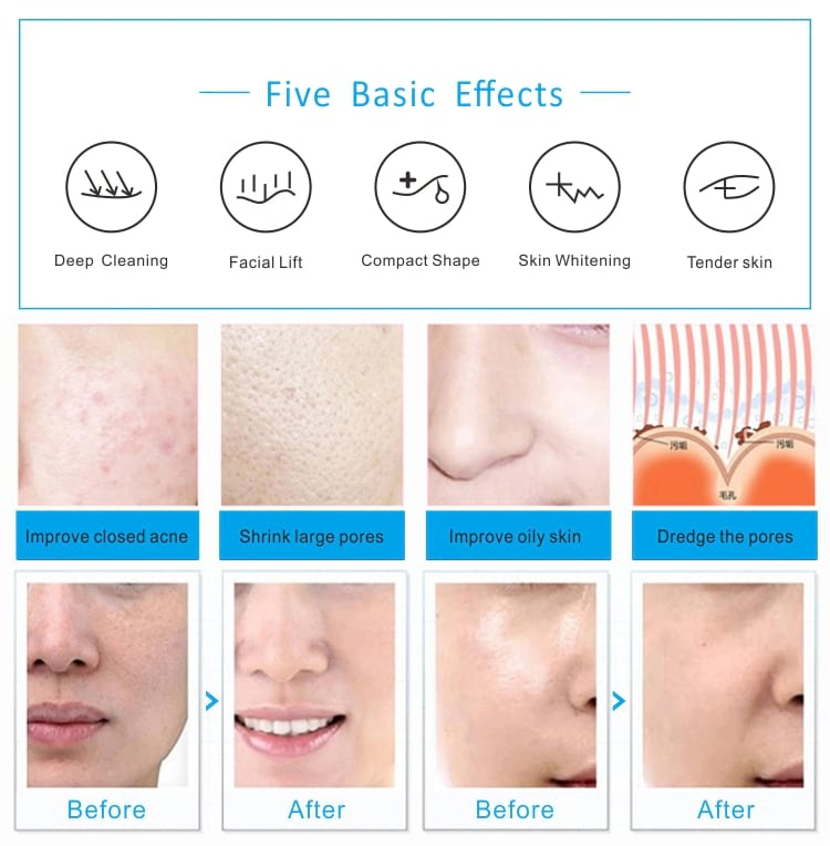 New Aqua Peeling Face Clean Skin Care BIO Light RF Vacuum Face Cleaning Hydro Water Oxygen Import Photobiomodulation Full Body PDT Lamp