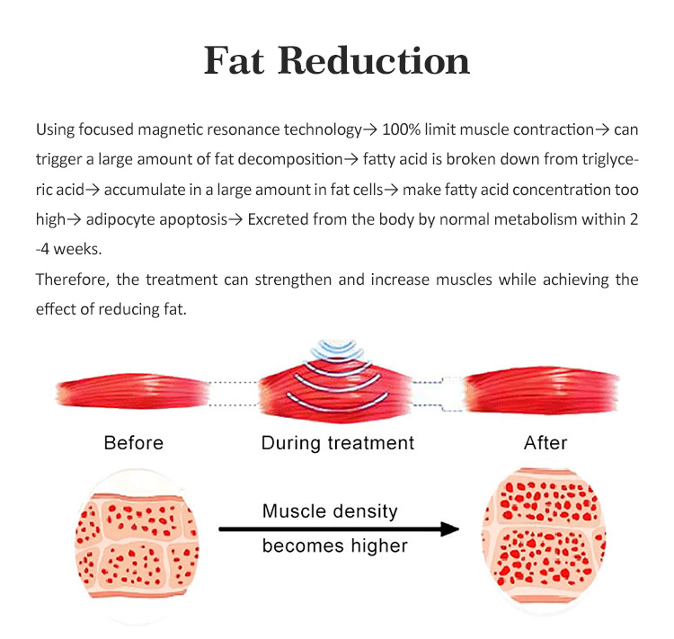 NEW EMSlim Pelvic Floor Muscle Postpartum Muscle Training Prostate treatment Massage Chair Machine Urinary Incontinence butt lift