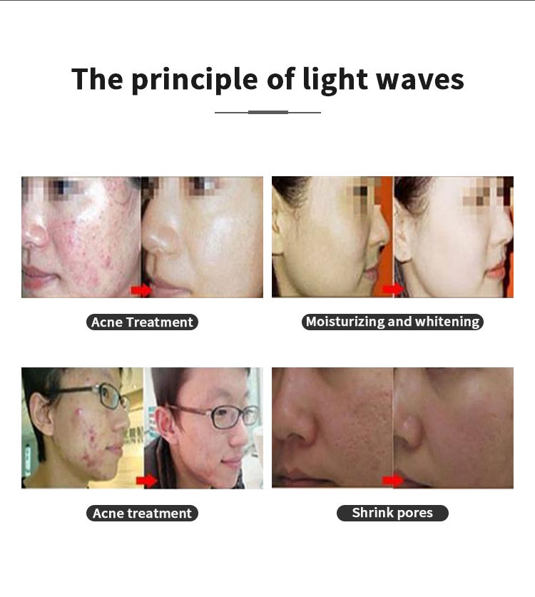 Best Quality LED Light Therapy Face Spa LED Light Treatment Skin Rejuvenation Tightening Acne Removal Professional 7 Color PDT LED Device