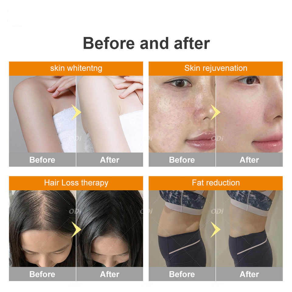 Collagen Therapy Solarium Tanning LED Bed Led Pain Relief Beauty Machine Full Body PDT Red Infrared Light Therapy Bed For Anti Aging Skin Rejuvenation