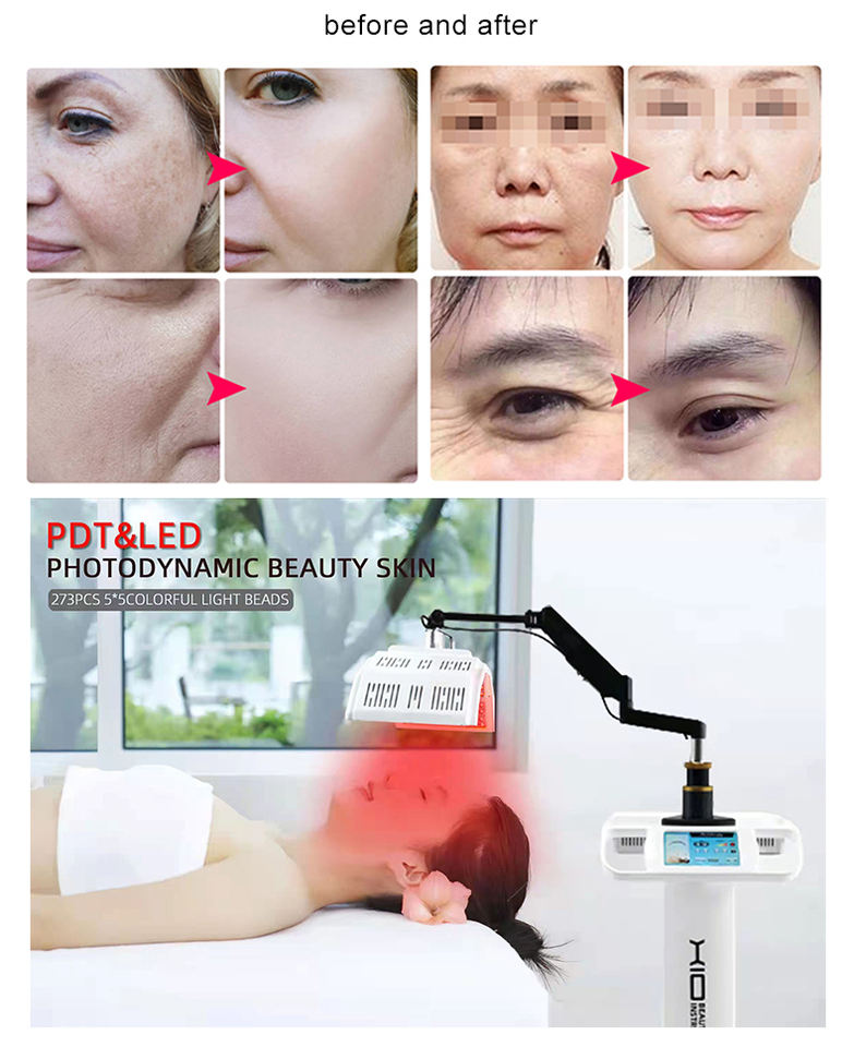 Effecctively Whitening Skin Rejuvenation Red Blue Light Led Skin Therapy 7 In 1 PDT Laser Equipment PDT Led Red Light Therapy Beauty Equipment
