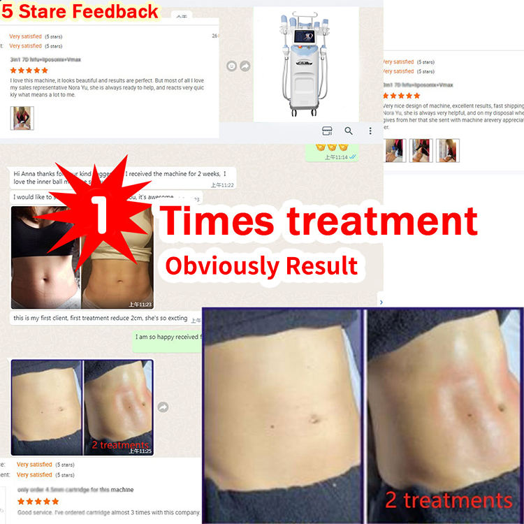 Professional Vacuum Face Body Fat Burning 360 Degree Cryo Slimming Cryotherapy Fat Freezing Machine