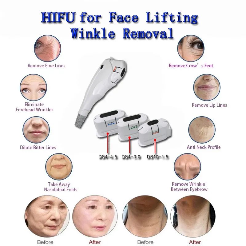 3D Hifu Treatment Heads Cartridge For Liposonic Body Sliming Fat Removal Loss Weight Machine Liposonix Fat Removal Beauty Machine