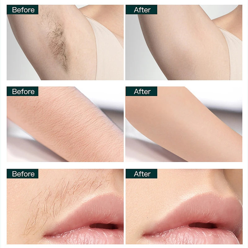 Epilator Women Electric Body Hair Removal Defeatherer Cotton Thread Depilator Beauty Personal Care Appliance 231020