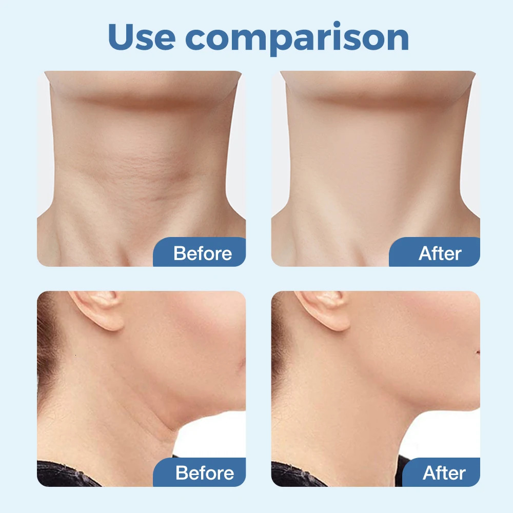 Face Massager EMS Thermal Neck Lifting and Tighten Massager Electric Microcurrent Wrinkle Remover LED Pon Face Beauty Device for Woman 231021