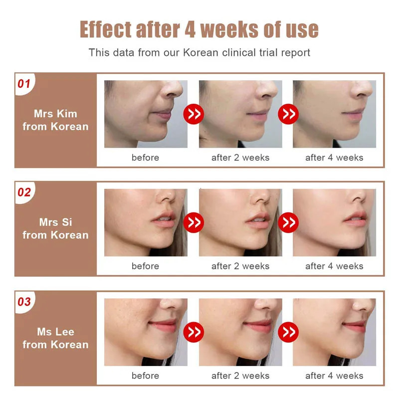Face Massager EMS Micro-current Face Lifting Device LED Pon Therapy Vibration Massage Double Chin V-line Lift Face Slimming Machine 231021
