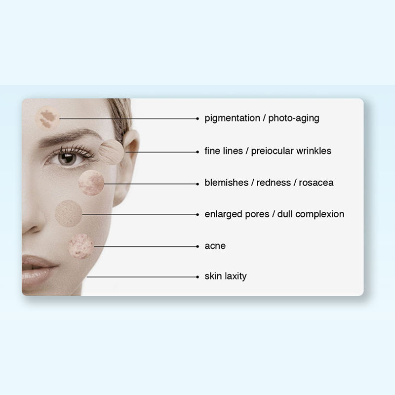 Body Skin Rejuvenation Acne Treatment Pigment Removal Beauty Pdt Led Light Therapy Machine