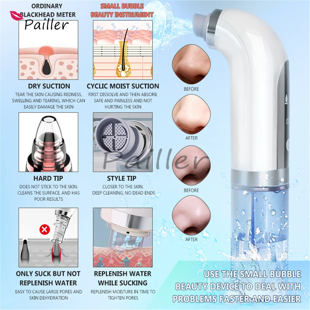 Cleaning Tools Accessories USB Charging Blackhead Meter 400mAh Electric Vacuum Acne Pore Cleaner Water Cycle Skin Deep Beauty Care 231023