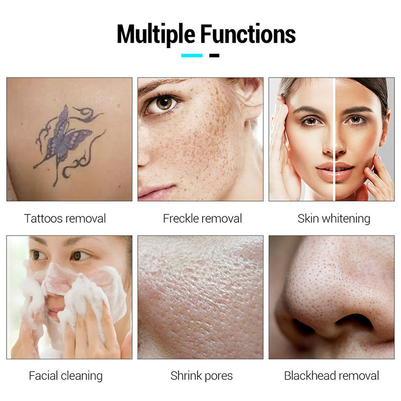 Powerful Picosecond Laser Tattoo Removal Q Switch ND Yag Laser Freckle Removal Eyebrow Washing Tattoo Removal Skin Rejuvenation Skin Whitening Machine