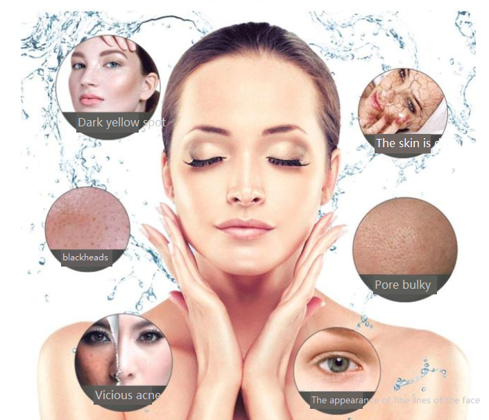Large Stocks Hydrodermabrasion Oxygen Therapy For Stroke Patients Oxygen For Deep Cleaning And Facial Care Beauty Equipment