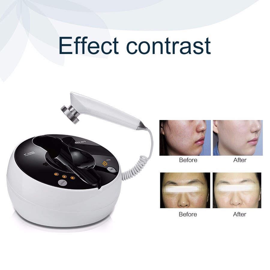 2024 RF Beauty Instrument for Home Use - Facial and Body Rejuvenation, Firming, Whitening, and Anti-Wrinkle Massage Device for Ultimate Skin Care