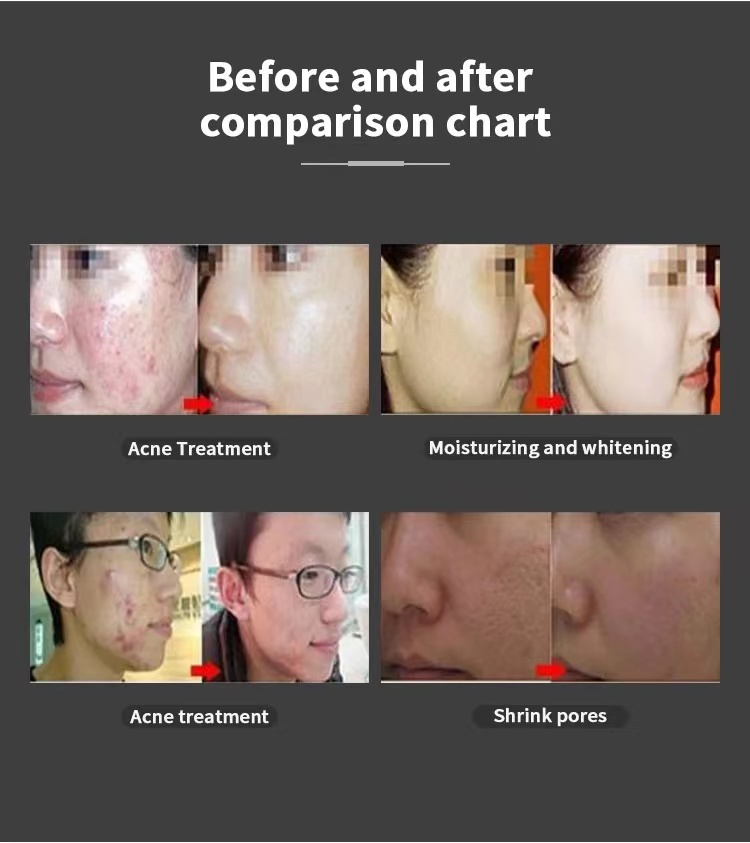 Skin Rejuvenation 7 Colors Pdt Led Light Therapy Machine Pdt/Led Facial Photon Beauty Equipment