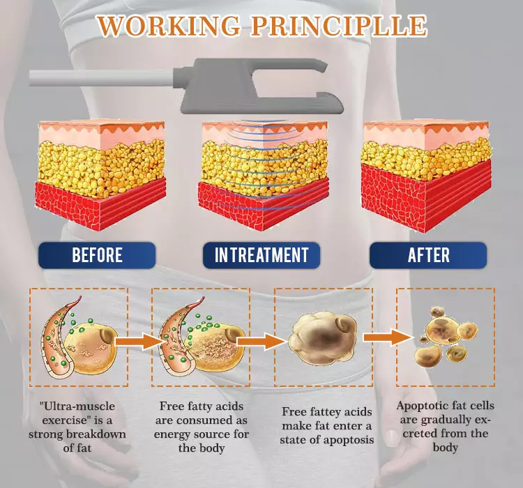 beauty Slimming equipment EMS electromagnetic Muscle Stimulation bulit body shaping device