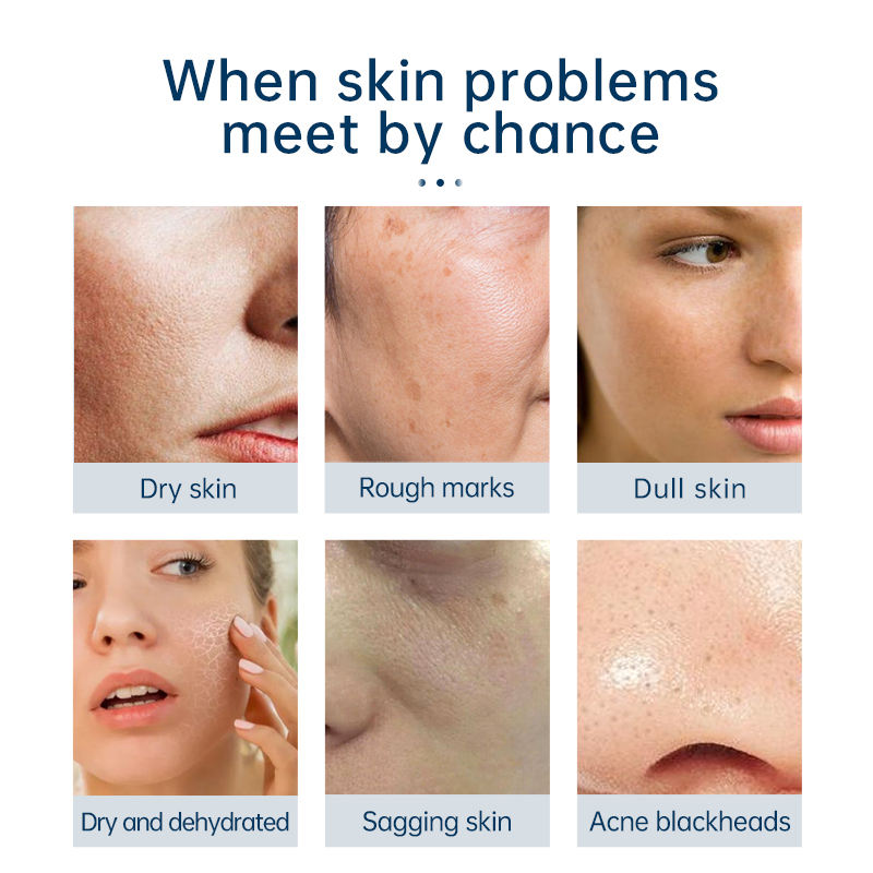 2022 dermabrasion deep cleansing machine water microdermabrasion Oxygen Spra Gun RF lift skin Scrubber black heads removal device