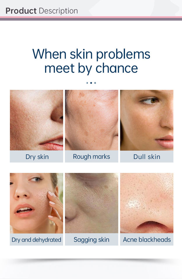 2022 dermabrasion deep cleansing machine water microdermabrasion Oxygen Spra Gun RF lift skin Scrubber black heads removal device