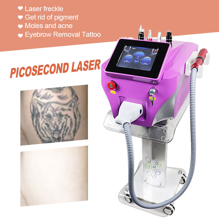 2024 New Arrivals Portable Picosecond Laser q Switch Tattoo Removal Eyebrow Wash Pigmentation Treatment CE
