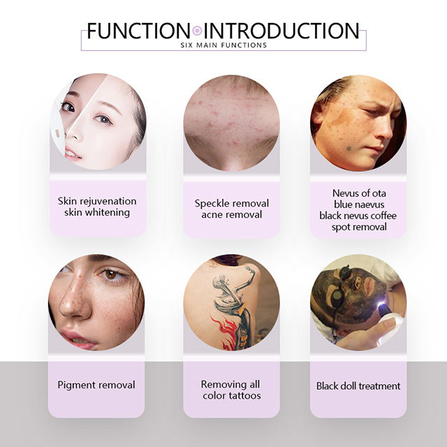 CE approved pigments tattoo removal varicose veins laser treatment q switched nd yag laser