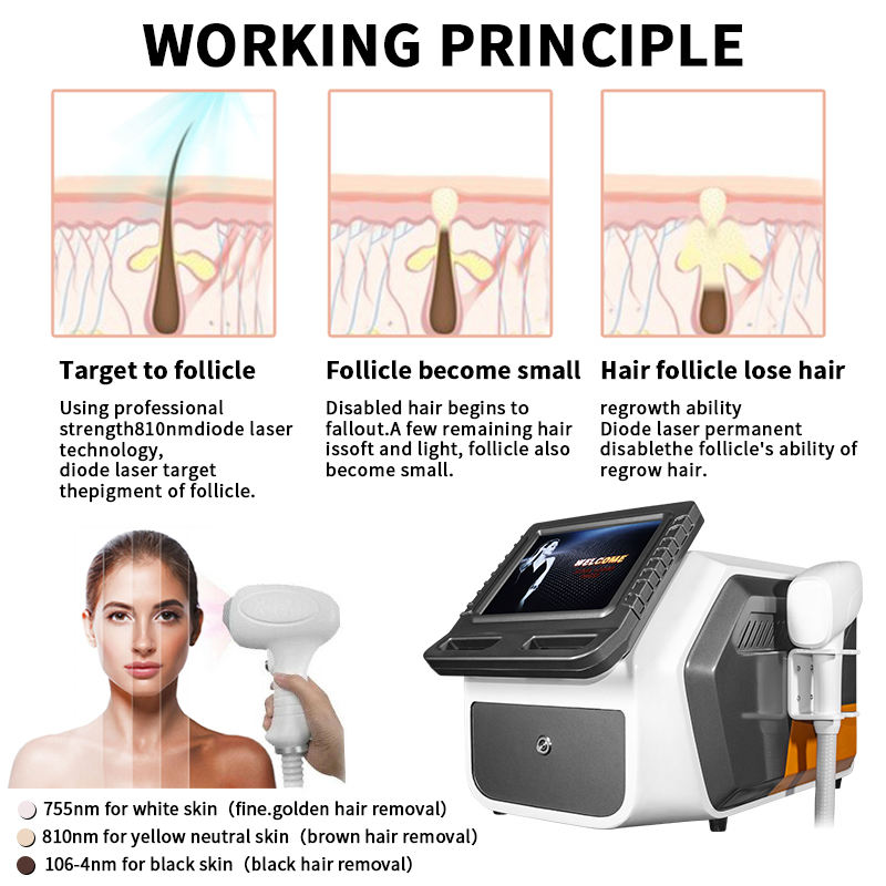 2023 Dark skin hair removal 3 Wavelengths 755 810 1064nm Larger Spot Size Permanent Diode Laser Alexandrite Hair Removal device