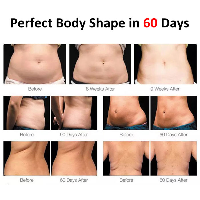 Portable Cryolipolysis Professional Machine Cryolipolise Cool Technology Fat Removal Device