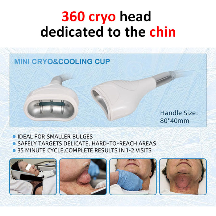 Portable Cryolipolysis Professional Machine Cryolipolise Cool Technology Fat Removal Device