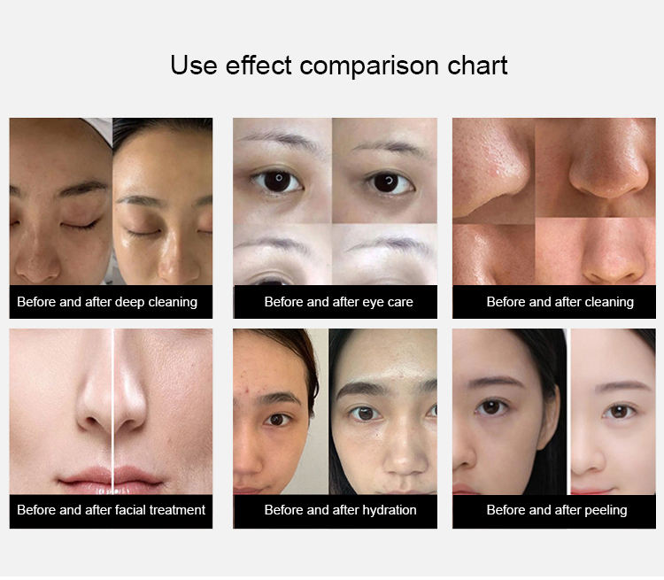 Microdermabrasion Beauty Machine Hydra Dermabrasion Aqua Peeling Spa Beauty Machine Oxygen Jet Peel Equipment