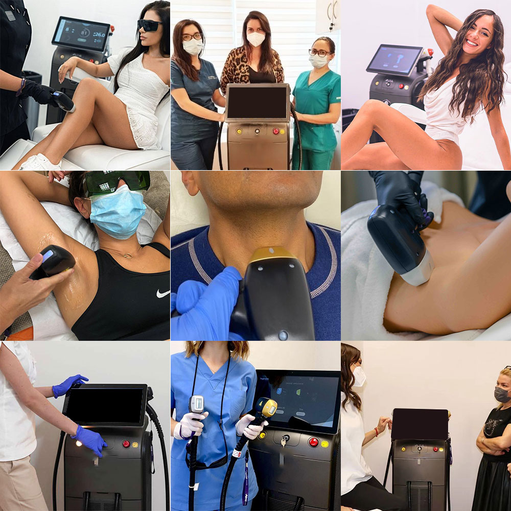 New Arrivals 2023 Hair Removal Laser 755 808 940 1064 Diode Laser Price
