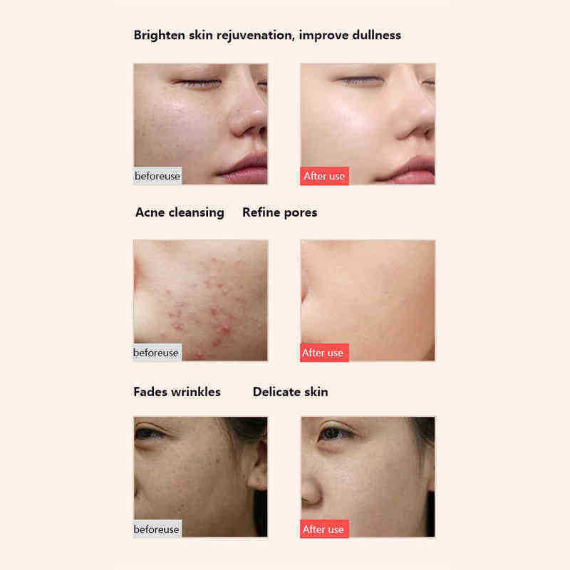 Led Photon Beauty Mask Skin Rejuvenation Machine Spa Acne Remover Blemish Anti Aging Wrinkle Instrument Lift Tighten 220516