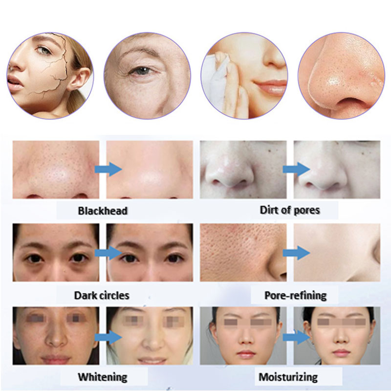 facial oxygen facial care machine microdermabrasion skin lifting Facial Machine For Oxygen Jet