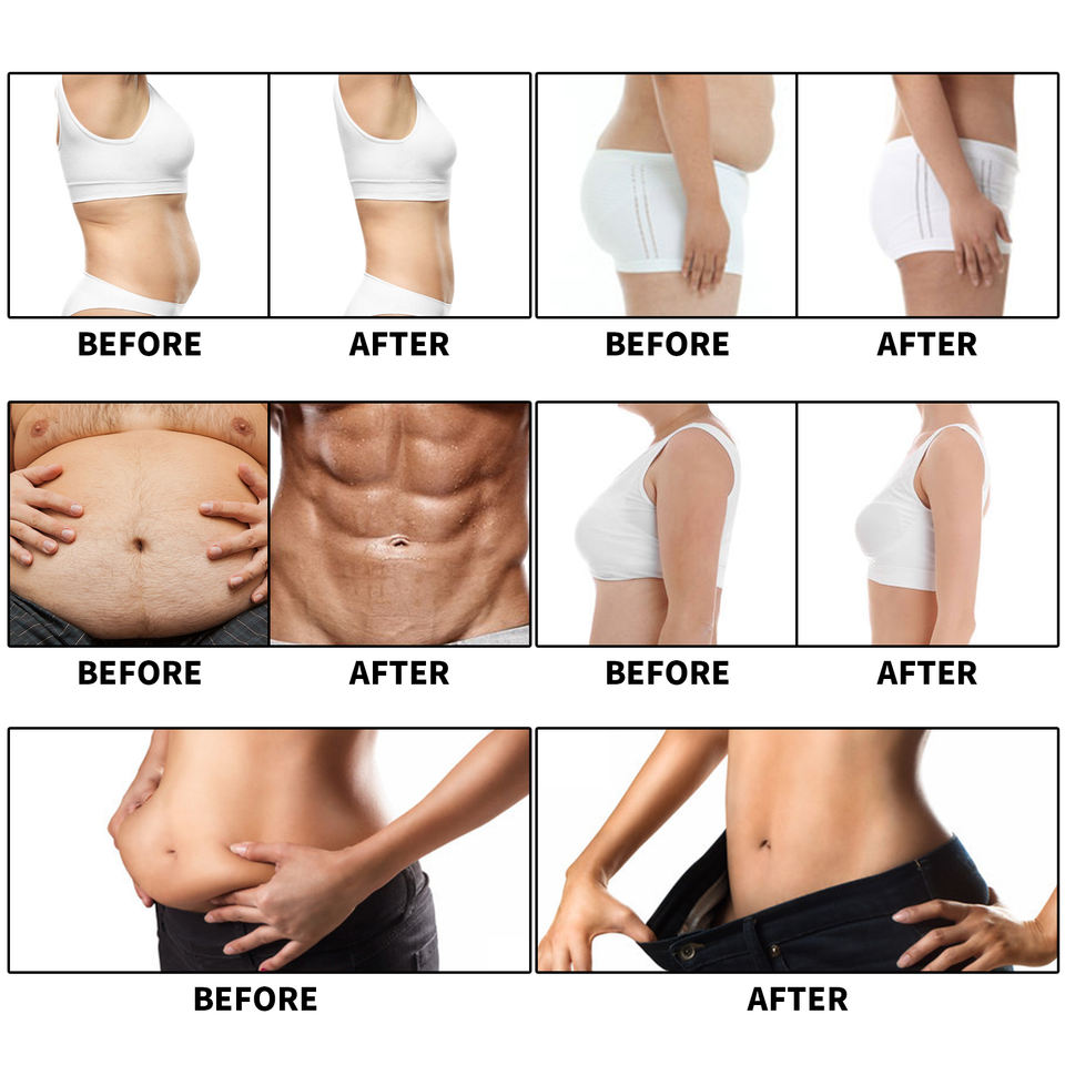 2023 Vertical 4 Handles Emslim Slimming Equipment Ems Fitness Body Contouring Pelvic Floor Training Machine