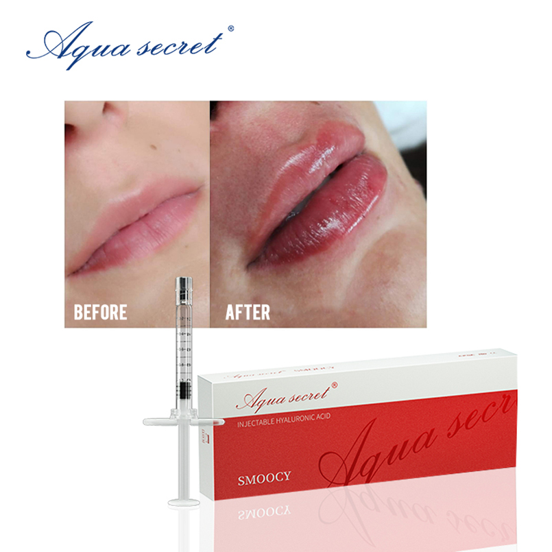 Aqua Secret buy Beauty Items cheek injection online 1ml 2ml dermal filler ha crosslinked lip filler
Aqua Secret buy Beauty Items cheek injection online 1ml 2ml dermal filler ha crosslinked lip filler