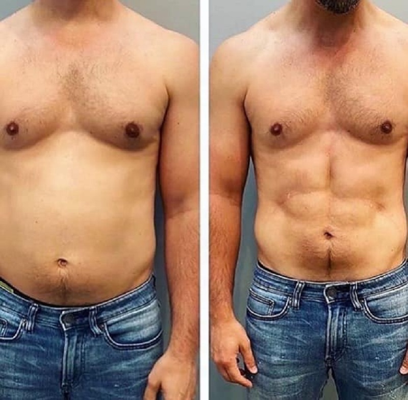 Slimming Machine Ems muscle stimulator with RF 5000W fat burn muscle build skin tightening