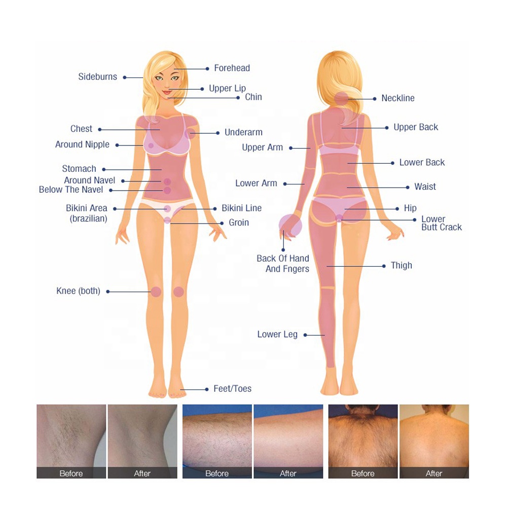 2023 Professional multifunctional Machine 4in1 IPL OPT E-Light Hair removal Tattoo removal Piocosecond Laser Beauty Equipment