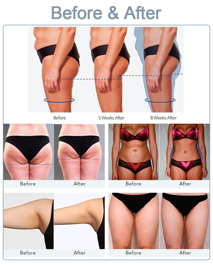 RF Body Sculpt Slimming Machine EMSLIM Neo Hiemt Muscle Stimul Device EMS Nova Pelvic Floor Stimulator for Butt Lift