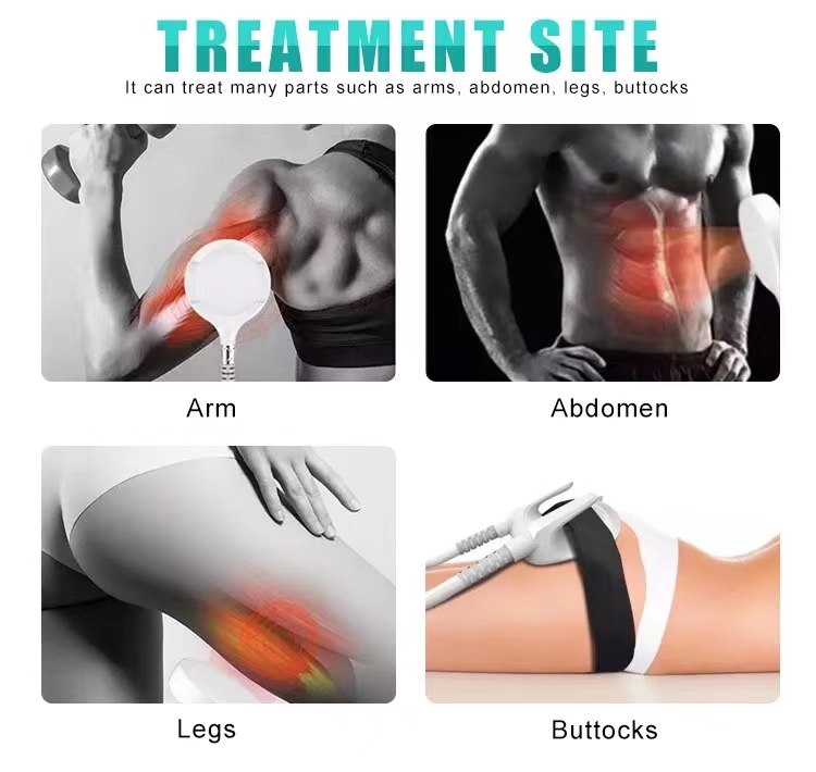 EMS Slimming Muscle Build Fat Burn Body Emslim Sculpting High Intensity Focused Electromagnetic Shaping