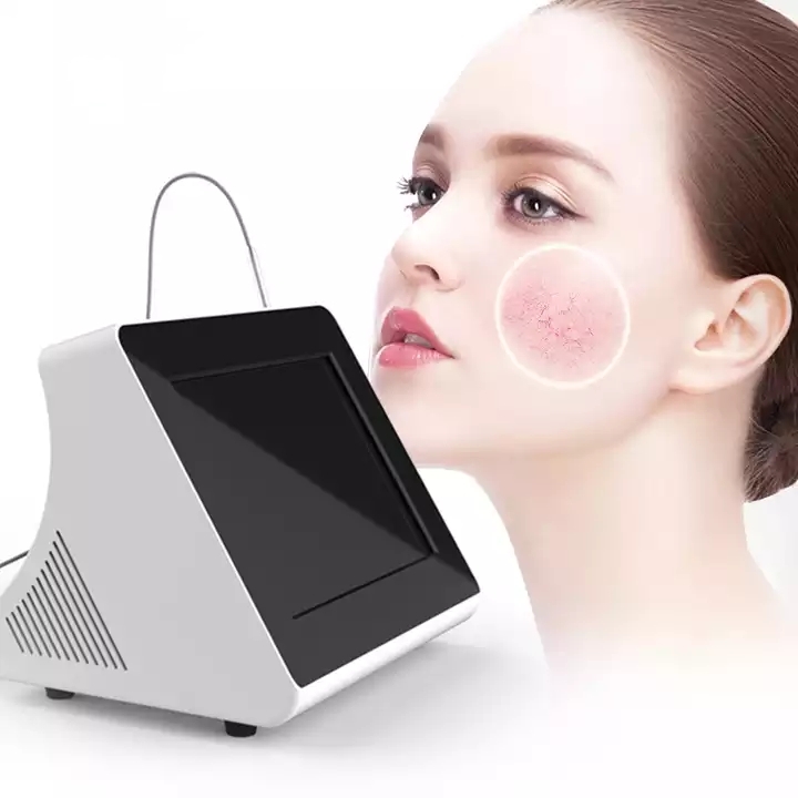 980nm RF Skin Tag Remover Device Portable Spider Vein Beauty Mole Tissue Red Veins Diode Laser Portable Removal Machine
980nm RF Skin Tag Remover Device Portable Spider Vein Beauty Mole Tissue Red Veins Diode Laser Portable Removal Machine