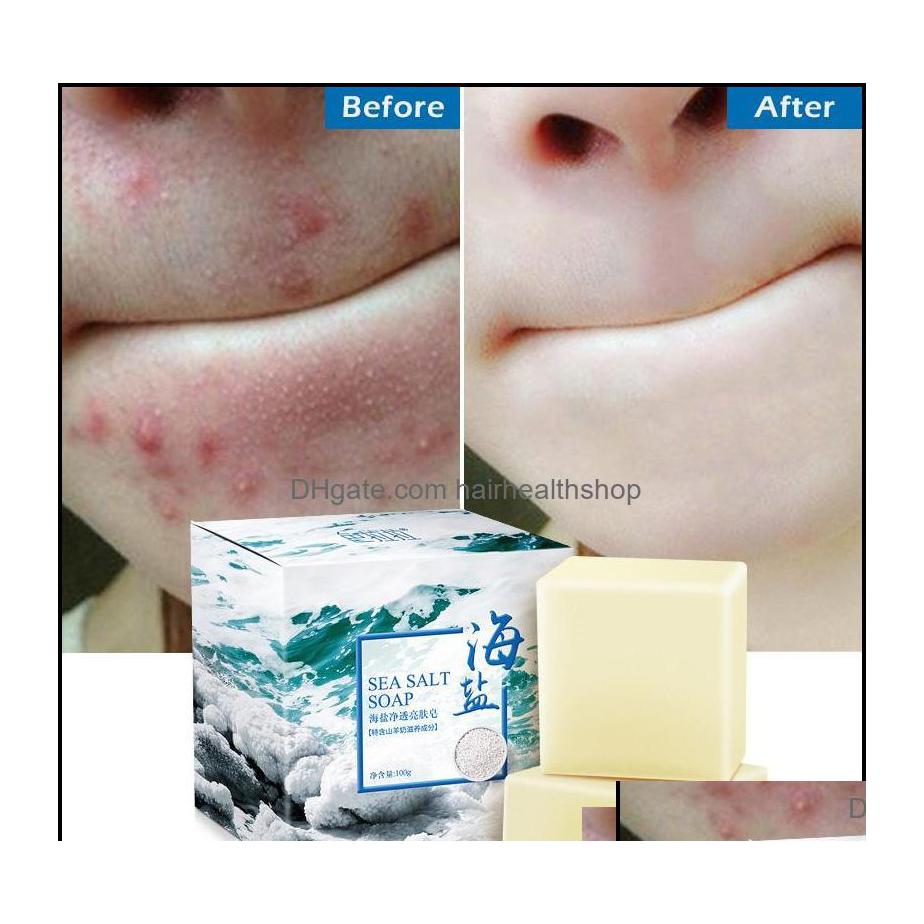 Handmade Soap Handmade Soap Bath Body Health Beauty 100G Removal Pimple Pores Acne Treatment Sea Salt Cleaner Goat Milk Moisturizing Ot0Uy
Handmade Soap Handmade Soap Bath Body Health Beauty 100G Removal Pimple Pores Acne Treatment Sea Salt Cleaner Goat Milk Moisturizing Ot0Uy